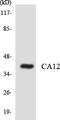 Carbonic Anhydrase 12 antibody, LS-B14660, Lifespan Biosciences, Western Blot image 