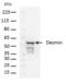 Desmin antibody, PA5-16705, Invitrogen Antibodies, Western Blot image 