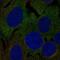 Leucine-rich repeat-containing protein 4C antibody, NBP2-58242, Novus Biologicals, Immunocytochemistry image 