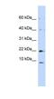 NADH:Ubiquinone Oxidoreductase Subunit C2 antibody, NBP1-59610, Novus Biologicals, Western Blot image 