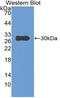 Insulin Like Growth Factor Binding Protein 4 antibody, LS-C294663, Lifespan Biosciences, Western Blot image 