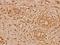 Cystatin B antibody, A02794, Boster Biological Technology, Immunohistochemistry paraffin image 