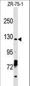 VPS50 Subunit Of EARP/GARPII Complex antibody, LS-C159280, Lifespan Biosciences, Western Blot image 