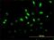 Mitogen-Activated Protein Kinase 6 antibody, H00005597-M02, Novus Biologicals, Immunofluorescence image 