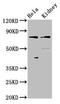 Chloride Voltage-Gated Channel Kb antibody, LS-C673560, Lifespan Biosciences, Western Blot image 