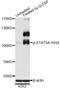 Signal Transducer And Activator Of Transcription 5A antibody, STJ22417, St John