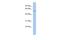 Zinc Finger Protein 410 antibody, A12077, Boster Biological Technology, Western Blot image 