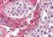 SET Nuclear Proto-Oncogene antibody, orb89331, Biorbyt, Immunohistochemistry paraffin image 