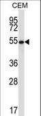 GA Binding Protein Transcription Factor Subunit Alpha antibody, LS-C166319, Lifespan Biosciences, Western Blot image 