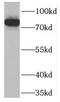 PDX1 C-Terminal Inhibiting Factor 1 antibody, FNab06209, FineTest, Western Blot image 