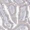 Methylenetetrahydrofolate Dehydrogenase (NADP+ Dependent) 2 Like antibody, NBP1-82663, Novus Biologicals, Immunohistochemistry frozen image 