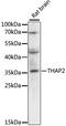 THAP Domain Containing 2 antibody, 19-085, ProSci, Western Blot image 