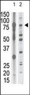 Matrix Metallopeptidase 15 antibody, PA5-13184, Invitrogen Antibodies, Western Blot image 