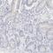 One Cut Homeobox 1 antibody, NBP1-91998, Novus Biologicals, Immunohistochemistry paraffin image 