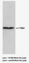 Collagen Type III Alpha 1 Chain antibody, LS-C171119, Lifespan Biosciences, Western Blot image 