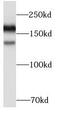 EGFR antibody, FNab10146, FineTest, Western Blot image 
