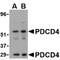Programmed Cell Death 4 antibody, 3975, ProSci, Western Blot image 