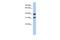 SET Domain Containing 9 antibody, A17608, Boster Biological Technology, Western Blot image 