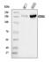 Lysine Demethylase 6A antibody, A01286-2, Boster Biological Technology, Western Blot image 