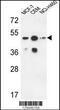 Sphingomyelin Synthase 2 antibody, 64-125, ProSci, Western Blot image 