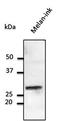 RAB32, Member RAS Oncogene Family antibody, orb11624, Biorbyt, Western Blot image 