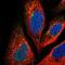 RuvB Like AAA ATPase 1 antibody, NBP1-84913, Novus Biologicals, Immunocytochemistry image 