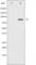 Signal Transducer And Activator Of Transcription 5A antibody, abx011813, Abbexa, Western Blot image 