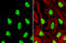 Heterogeneous Nuclear Ribonucleoprotein L antibody, GTX132754, GeneTex, Immunofluorescence image 