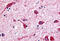 Cholinergic Receptor Muscarinic 2 antibody, MBS244587, MyBioSource, Immunohistochemistry frozen image 