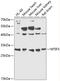 Mitochondrial Translational Initiation Factor 3 antibody, 14-542, ProSci, Western Blot image 