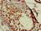 Survival Of Motor Neuron 2, Centromeric antibody, CSB-PA614982LA01HU, Cusabio, Immunohistochemistry frozen image 