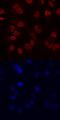 REST Corepressor 1 antibody, MA5-24297, Invitrogen Antibodies, Immunocytochemistry image 