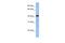 GDP-Mannose Pyrophosphorylase A antibody, A13702, Boster Biological Technology, Western Blot image 