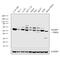 Nicotinamide Phosphoribosyltransferase antibody, PA5-23198, Invitrogen Antibodies, Western Blot image 