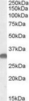 OTU Deubiquitinase, Ubiquitin Aldehyde Binding 1 antibody, NBP1-20957, Novus Biologicals, Western Blot image 
