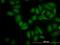 Serum/Glucocorticoid Regulated Kinase 2 antibody, H00010110-M05, Novus Biologicals, Immunofluorescence image 