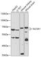 Sodium/glucose cotransporter 1 antibody, 18-954, ProSci, Western Blot image 