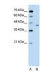 LRP2 Binding Protein antibody, NBP1-70620, Novus Biologicals, Western Blot image 