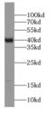 ST8 Alpha-N-Acetyl-Neuraminide Alpha-2,8-Sialyltransferase 2 antibody, FNab08276, FineTest, Western Blot image 