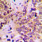 Glycogen Synthase Kinase 3 Beta antibody, LS-C356083, Lifespan Biosciences, Immunohistochemistry paraffin image 