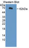 Cytochrome P450 Family 1 Subfamily A Member 1 antibody, LS-C703361, Lifespan Biosciences, Western Blot image 