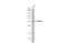 BCL2 Interacting Protein 3 Like antibody, GTX636515, GeneTex, Western Blot image 