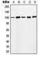 Minichromosome Maintenance Complex Component 4 antibody, MBS820857, MyBioSource, Western Blot image 