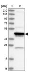 ADP Ribosylation Factor Interacting Protein 1 antibody, NBP2-38342, Novus Biologicals, Western Blot image 