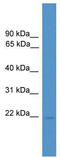 Rhox homeobox family member 1 antibody, TA331658, Origene, Western Blot image 