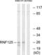 Ring Finger Protein 125 antibody, LS-B11326, Lifespan Biosciences, Western Blot image 