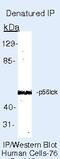 LCK Proto-Oncogene, Src Family Tyrosine Kinase antibody, MA5-12303, Invitrogen Antibodies, Immunoprecipitation image 