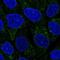 Transmembrane Protein 40 antibody, PA5-60636, Invitrogen Antibodies, Immunofluorescence image 