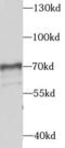 Syntaxin Binding Protein 4 antibody, FNab08363, FineTest, Western Blot image 