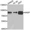 Nuclear Autoantigenic Sperm Protein antibody, A6938, ABclonal Technology, Western Blot image 